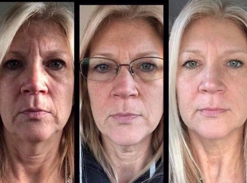 RevitaHepa ™ AHP powerful skin reshape cell drops(🎁Completely eliminate wrinkles and loose skin💯)